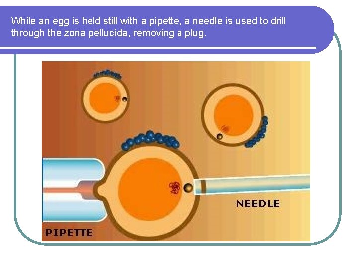 While an egg is held still with a pipette, a needle is used to