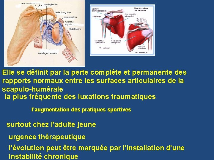 Elle se définit par la perte complète et permanente des rapports normaux entre les