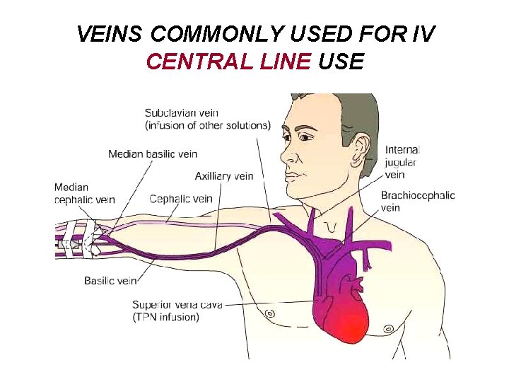 VEINS COMMONLY USED FOR IV CENTRAL LINE USE 