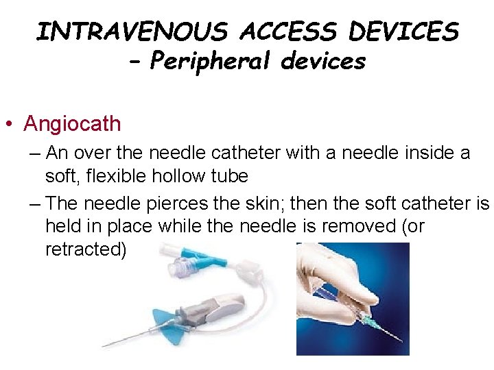 INTRAVENOUS ACCESS DEVICES – Peripheral devices • Angiocath – An over the needle catheter