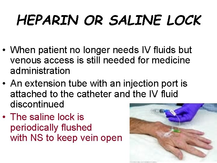 HEPARIN OR SALINE LOCK • When patient no longer needs IV fluids but venous