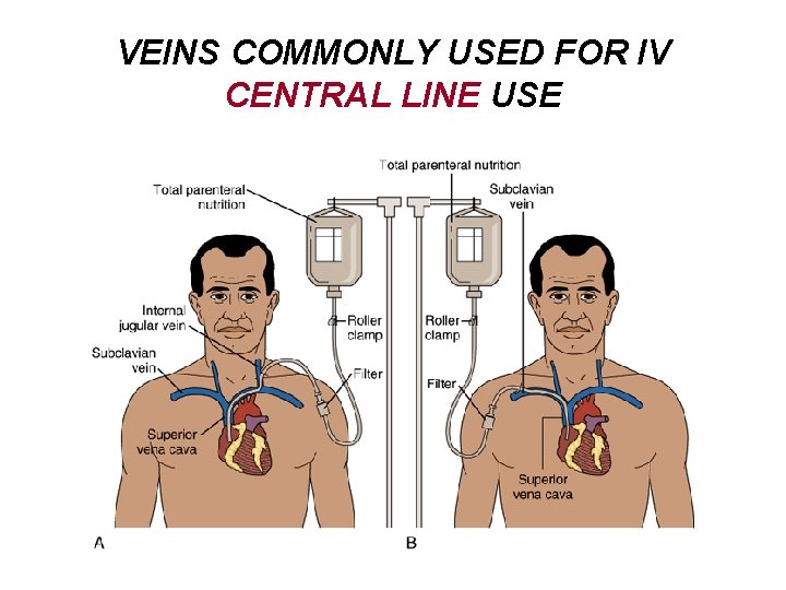 VEINS COMMONLY USED FOR IV CENTRAL LINE USE 
