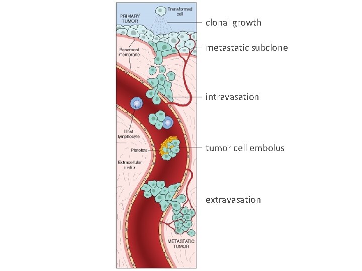 clonal growth metastatic subclone intravasation tumor cell embolus extravasation 