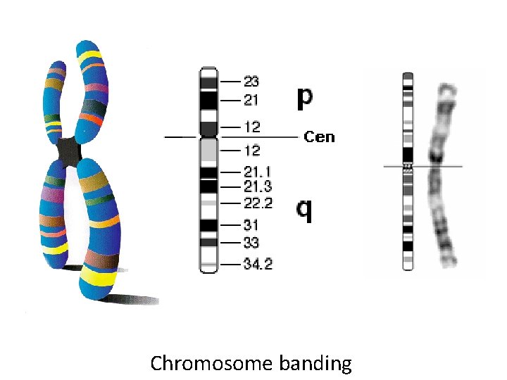 Chromosome banding 