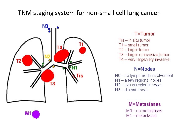 TNM staging system for non-small cell lung cancer T=Tumor Tis – in situ tumor