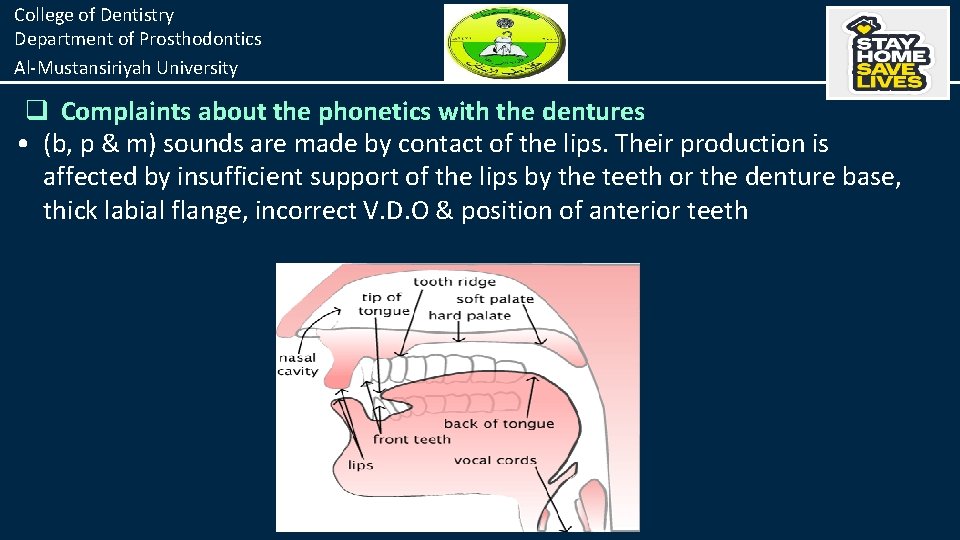 College of Dentistry Department of Prosthodontics Al-Mustansiriyah University q Complaints about the phonetics with