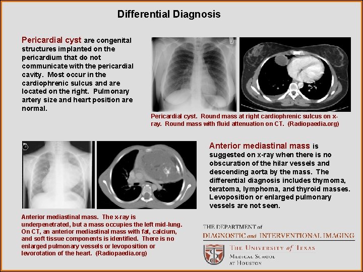 Differential Diagnosis Pericardial cyst are congenital structures implanted on the pericardium that do not