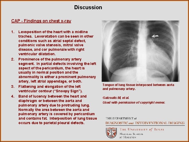Discussion CAP - Findings on chest x-ray 1. 2. 3. 4. Levoposition of the