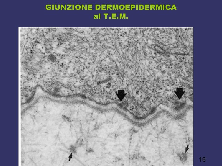 GIUNZIONE DERMOEPIDERMICA al T. E. M. 16 