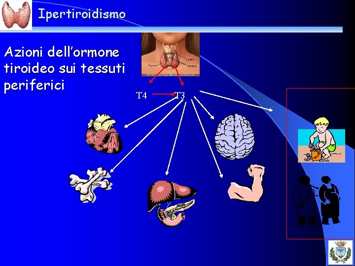 Ipertiroidismo Azioni dell’ormone tiroideo sui tessuti periferici T 4 T 3 