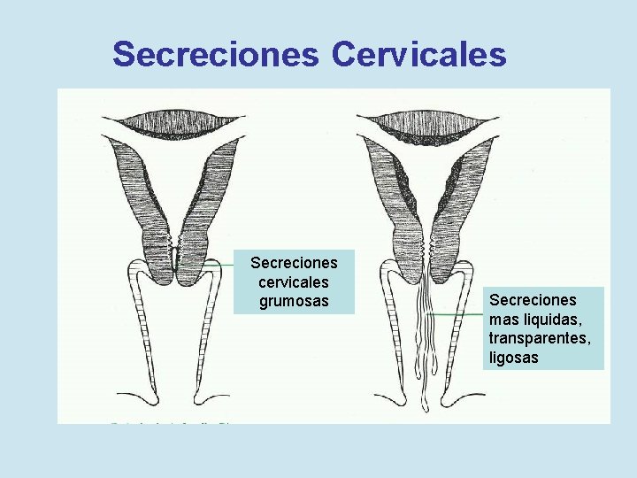 Secreciones Cervicales Secreciones cervicales grumosas Secreciones mas liquidas, transparentes, ligosas 