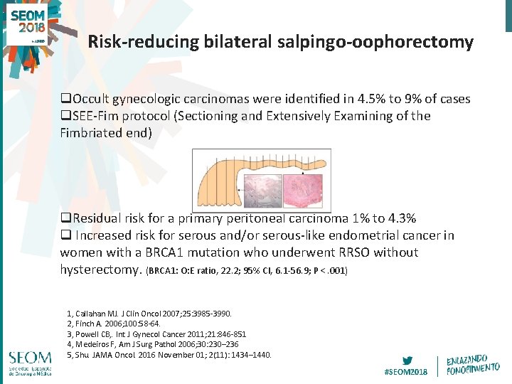 Risk-reducing bilateral salpingo-oophorectomy q. Occult gynecologic carcinomas were identified in 4. 5% to 9%