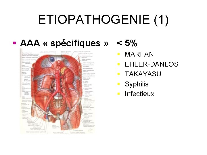 ETIOPATHOGENIE (1) § AAA « spécifiques » < 5% § § § MARFAN EHLER-DANLOS