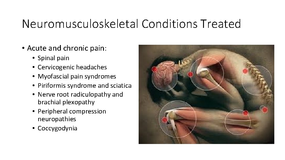 Neuromusculoskeletal Conditions Treated • Acute and chronic pain: Spinal pain Cervicogenic headaches Myofascial pain