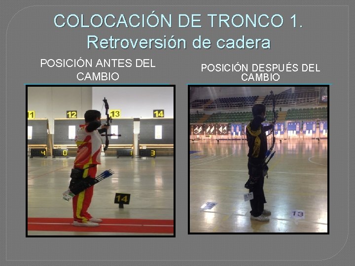 COLOCACIÓN DE TRONCO 1. Retroversión de cadera POSICIÓN ANTES DEL CAMBIO POSICIÓN DESPUÉS DEL