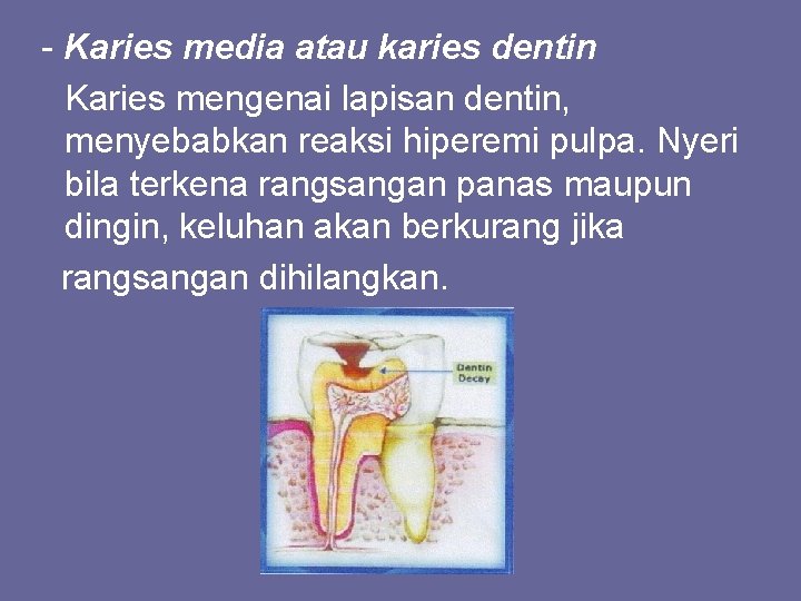 - Karies media atau karies dentin Karies mengenai lapisan dentin, menyebabkan reaksi hiperemi pulpa.