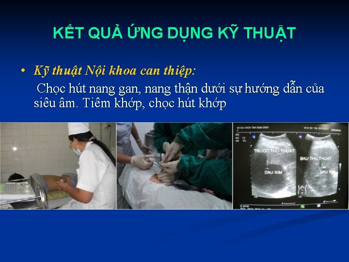 KẾT QUẢ ỨNG DỤNG KỸ THUẬT • Kỹ thuật Nội khoa can thiệp: Chọc