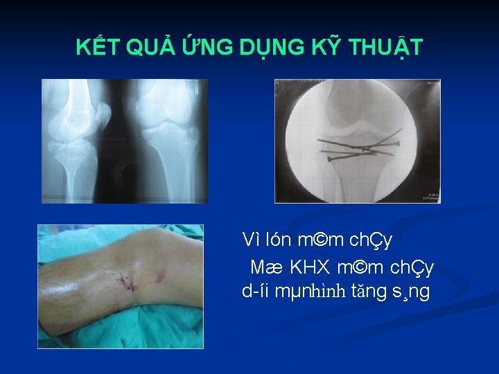 KẾT QUẢ ỨNG DỤNG KỸ THUẬT Vì lón m©m chÇy Mæ KHX m©m chÇy