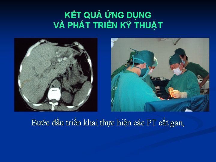 KẾT QUẢ ỨNG DỤNG VÀ PHÁT TRIỂN KỸ THUẬT Bước đầu triển khai thực