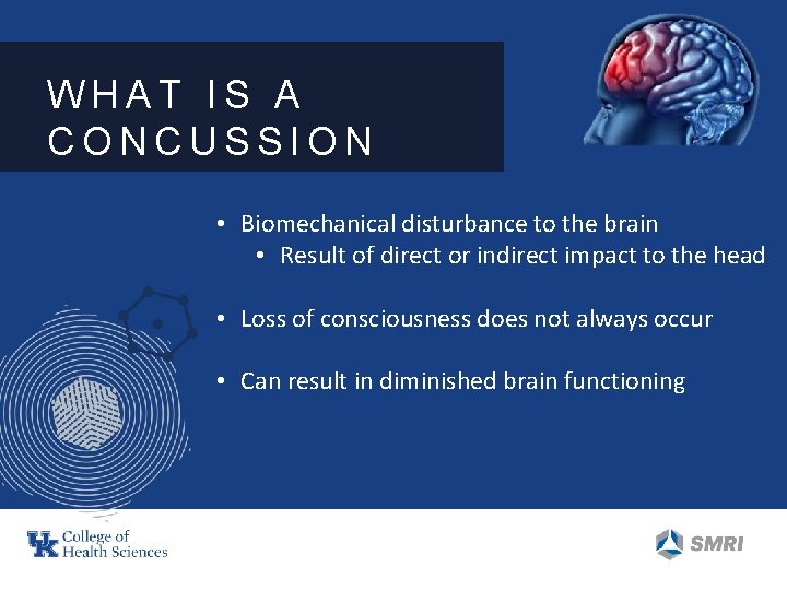 WHAT IS A CONCUSSION • Biomechanical disturbance to the brain • Result of direct