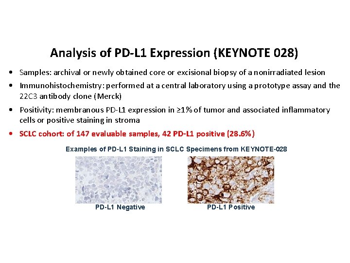 Analysis of PD-L 1 Expression (KEYNOTE 028) • Samples: archival or newly obtained core