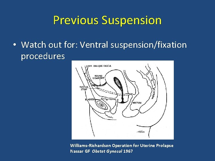 Previous Suspension • Watch out for: Ventral suspension/fixation procedures Williams-Richardson Operation for Uterine Prolapse