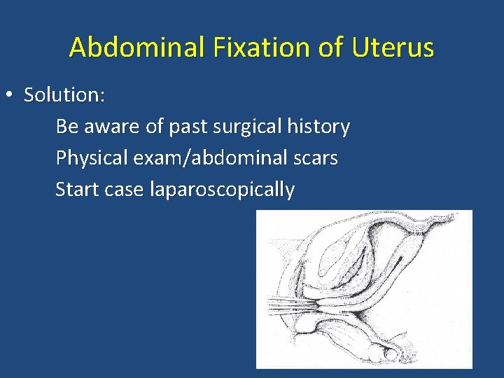 Abdominal Fixation of Uterus • Solution: Be aware of past surgical history Physical exam/abdominal