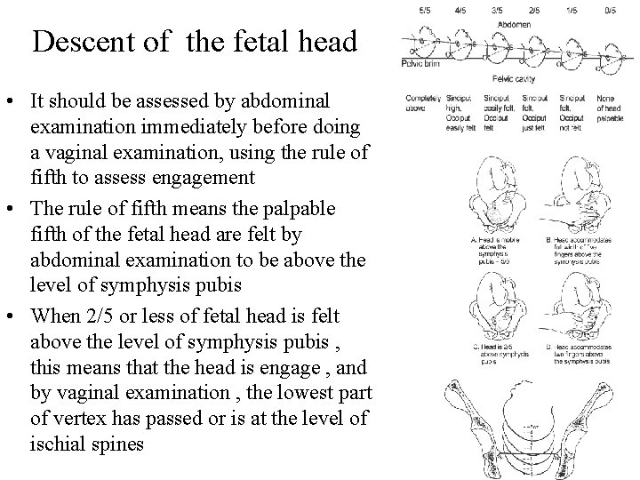 Descent of the fetal head • It should be assessed by abdominal examination immediately
