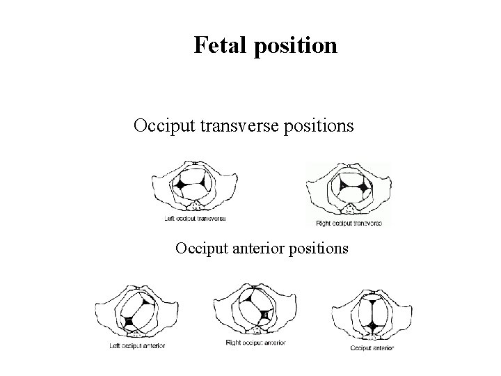 Fetal position Occiput transverse positions Occiput anterior positions 