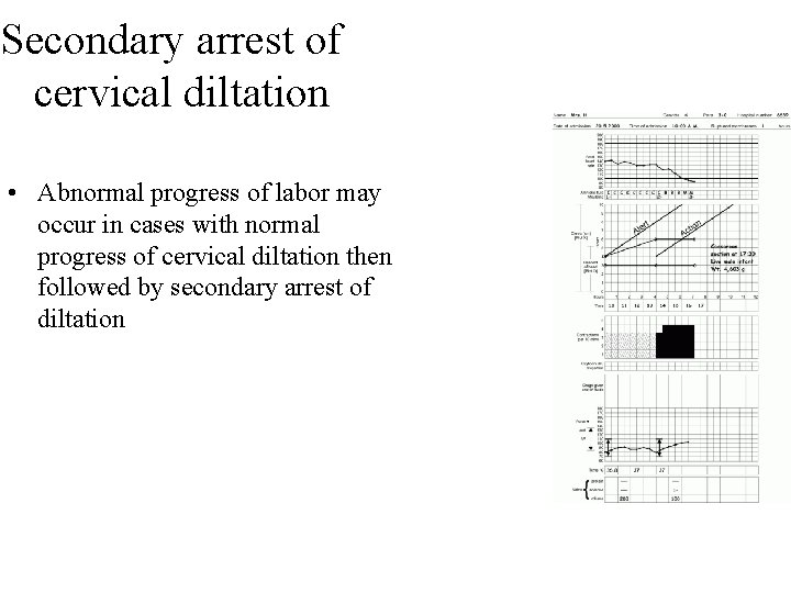 Secondary arrest of cervical diltation • Abnormal progress of labor may occur in cases