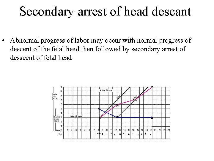 Secondary arrest of head descant • Abnormal progress of labor may occur with normal