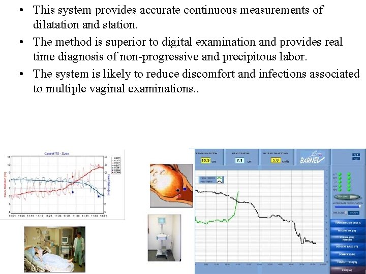  • This system provides accurate continuous measurements of dilatation and station. • The