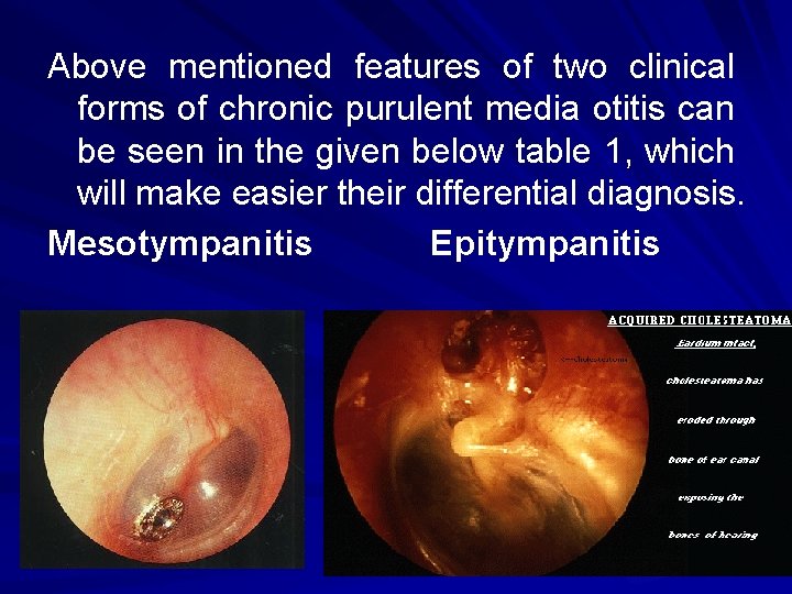 Above mentioned features of two clinical forms of chronic purulent media otitis can be