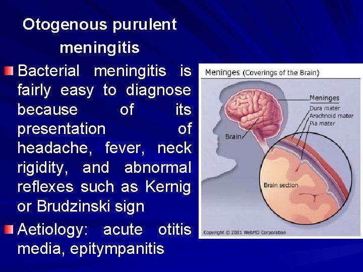 Otogenous purulent meningitis Bacterial meningitis is fairly easy to diagnose because of its presentation