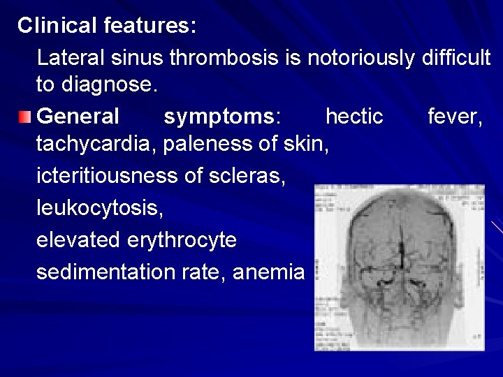 Clinical features: Lateral sinus thrombosis is notoriously difficult to diagnose. General symptoms: hectic fever,