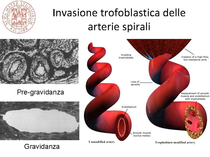 Invasione trofoblastica delle arterie spirali Pre-gravidanza Gravidanza 