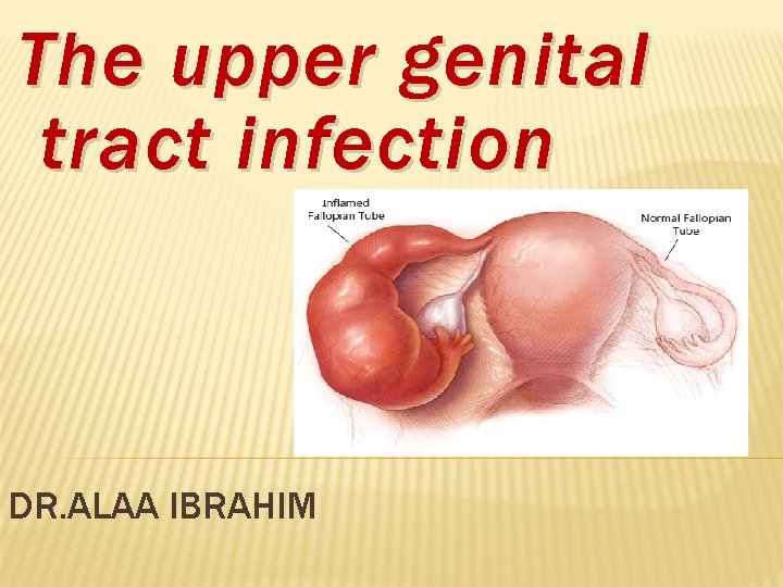 The upper genital tract infection DR. ALAA IBRAHIM 