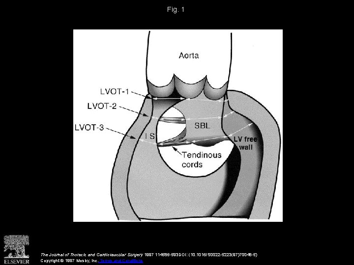 Fig. 1 The Journal of Thoracic and Cardiovascular Surgery 1997 114586 -593 DOI: (10.