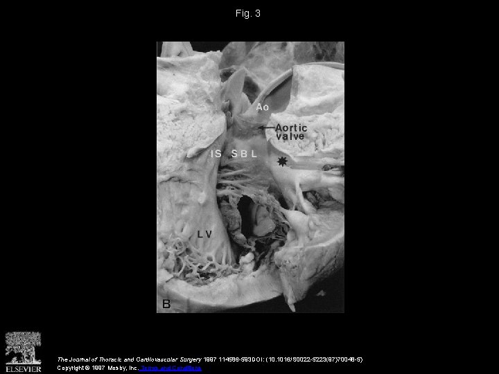 Fig. 3 The Journal of Thoracic and Cardiovascular Surgery 1997 114586 -593 DOI: (10.