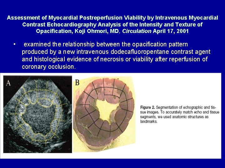 Assessment of Myocardial Postreperfusion Viability by Intravenous Myocardial Contrast Echocardiography Analysis of the Intensity Assessment of Myocardial Postreperfusion Viability by Intravenous Myocardial Contrast Echocardiography Analysis of the Intensity