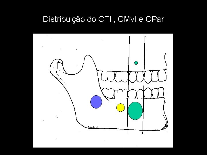 Distribuição do CFI , CMv. I e CPar 