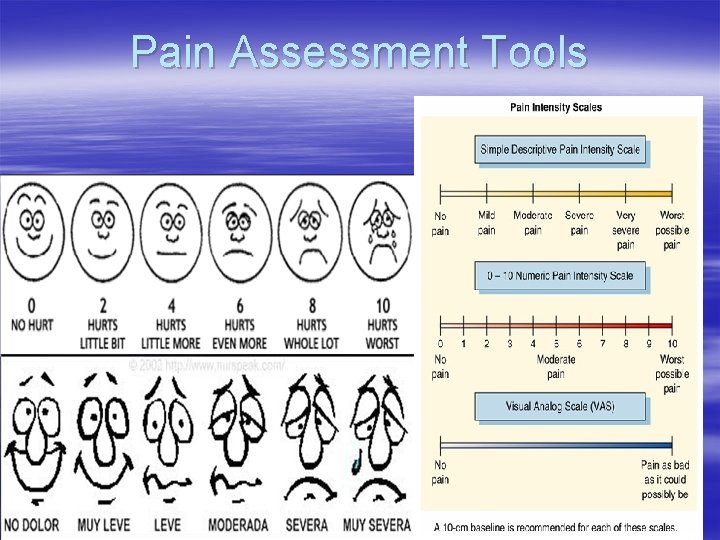 Pain Assessment Tools 