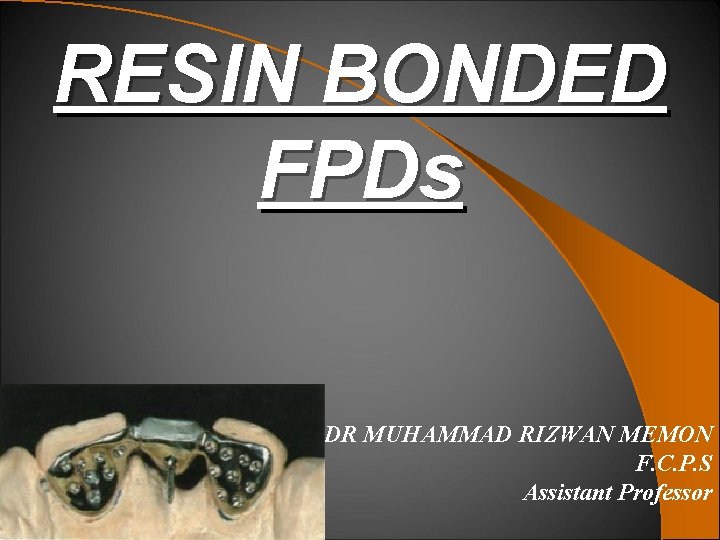 RESIN BONDED FPDs DR MUHAMMAD RIZWAN MEMON F. C. P. S Assistant Professor 