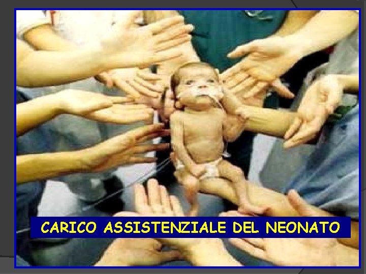 CARICO ASSISTENZIALE DEL NEONATO 