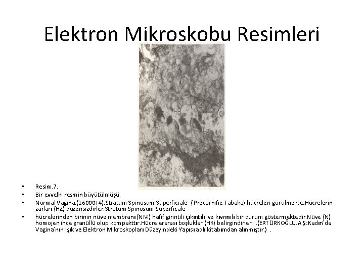 Elektron Mikroskobu Resimleri • • Resim. 7. Bir evvelki resmin büyütülmüşü. Normal Vagina. (16000+4).