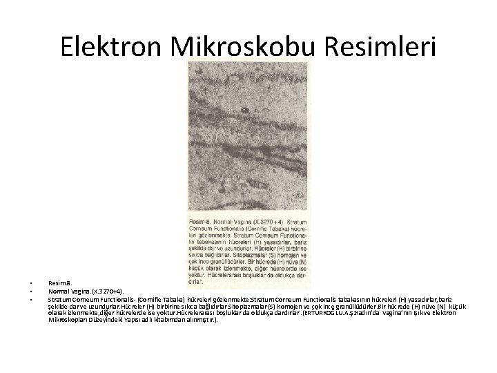 Elektron Mikroskobu Resimleri • • • Resim. 8. Normal Vagina. (X. 3270+4). Stratum Corneum