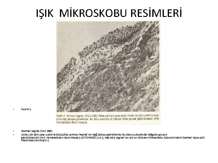 IŞIK MİKROSKOBU RESİMLERİ • Resim-1. • • Normal Vagina. (H+E. 200). Üstte çok katlı