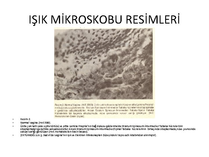 IŞIK MİKROSKOBU RESİMLERİ • • Resim-2. Normal Vagina. (H+E. 500). Üstte çok katlı yassı