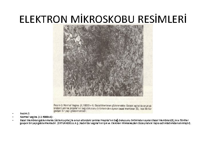 ELEKTRON MİKROSKOBU RESİMLERİ • • • Resim. 3. Normal Vagina. (X. 16000+4): Bazal Membran