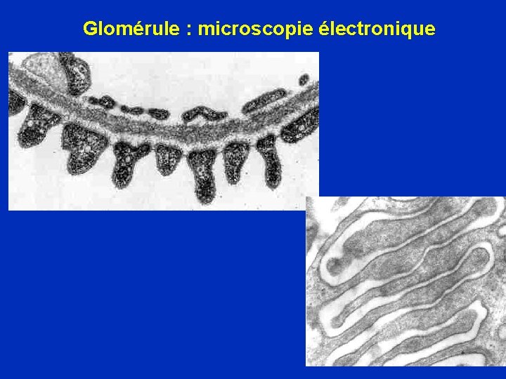 Glomérule : microscopie électronique 